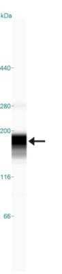 Simple Western: ATAD2 Antibody (CL0182) [NBP2-14786]
