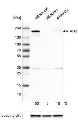 Western Blot: ATAD2 Antibody (CL0182) [NBP2-14786]