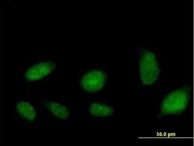 Immunocytochemistry/ Immunofluorescence: ATAD2 Antibody [H00029028-B01P]