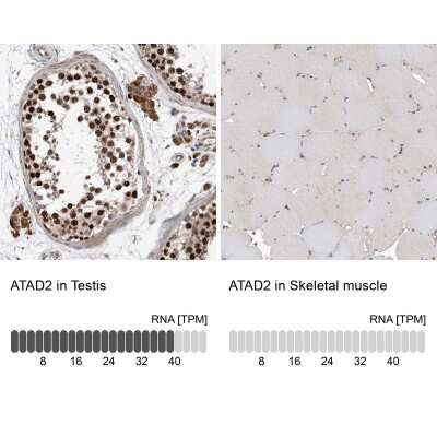 Immunohistochemistry-Paraffin: ATAD2 Antibody [NBP1-84123]