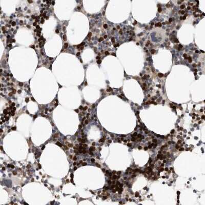 Immunohistochemistry-Paraffin: ATAD2 Antibody [NBP1-84123]