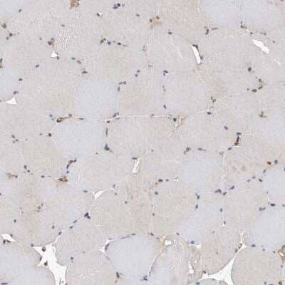 Immunohistochemistry-Paraffin: ATAD2 Antibody [NBP1-84123]