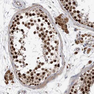 Immunohistochemistry-Paraffin: ATAD2 Antibody [NBP1-84123]