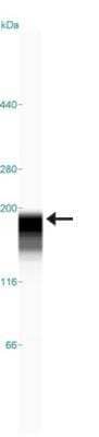 Simple Western: ATAD2 Antibody [NBP1-84123]