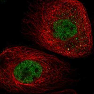 Immunocytochemistry/ Immunofluorescence: ATAD2B Antibody [NBP1-89611]