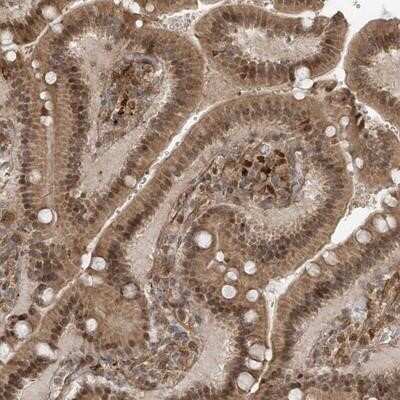 Immunohistochemistry-Paraffin: ATAD2B Antibody [NBP1-89611]