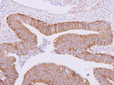 Immunohistochemistry-Paraffin: ATAD3A Antibody [NBP2-14881]