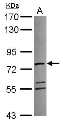 Western Blot: ATAD3A Antibody [NBP2-14881]