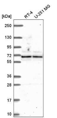 Western Blot: ATAD3A Antibody [NBP2-55766]