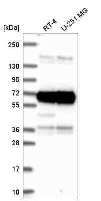 Western Blot: ATAD3A Antibody [NBP2-57335]