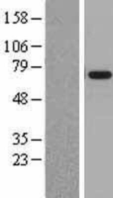 Western Blot: ATAD3A Overexpression Lysate [NBL1-07782]