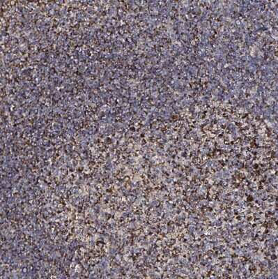 Immunohistochemistry-Paraffin: ATAD3B Antibody [NBP2-32409]