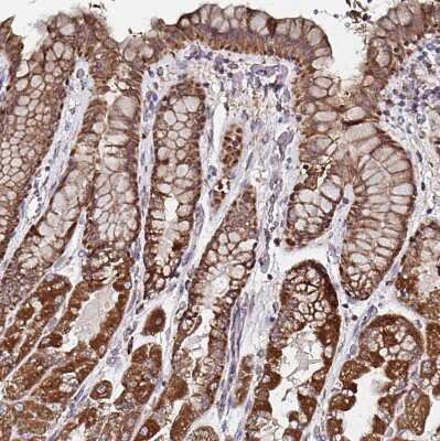 Immunohistochemistry-Paraffin: ATAD3B Antibody [NBP2-32409]
