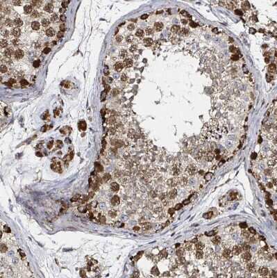 Immunohistochemistry-Paraffin: ATAD3B Antibody [NBP2-32409]