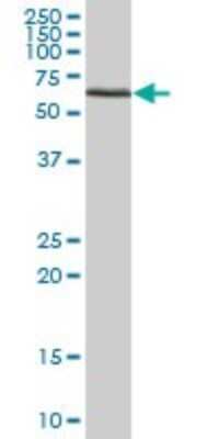 Western Blot: ATAD3B Antibody [H00083858-B01P]