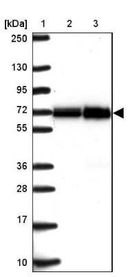 Western Blot: ATAD3B Antibody [NBP2-32409]