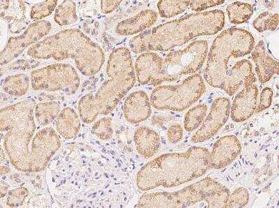 Immunohistochemistry-Paraffin: ATAD4 Antibody [NBP3-06059]