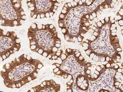 Immunohistochemistry-Paraffin: ATAD4 Antibody [NBP3-06059]