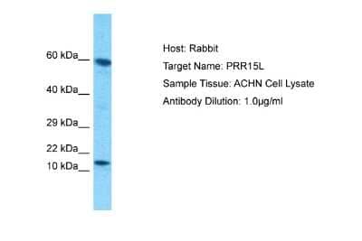 Western Blot: ATAD4 Antibody [NBP2-82690]