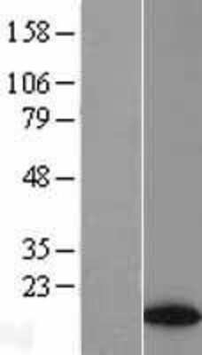 Western Blot: ATAD4 Overexpression Lysate [NBL1-07784]