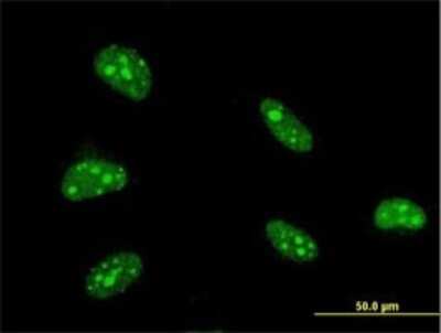 Immunocytochemistry/ Immunofluorescence: ATBF1/ZFHX3 Antibody (3B1) [H00000463-M01]