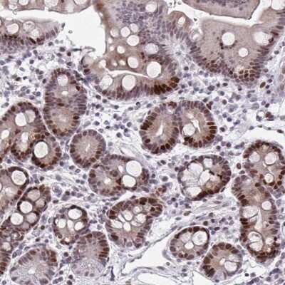 Immunohistochemistry-Paraffin: ATBF1/ZFHX3 Antibody [NBP2-34126]