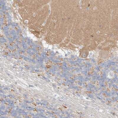Immunohistochemistry: ATCAY Antibody [NBP2-48537]