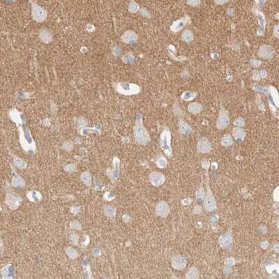 Immunohistochemistry-Paraffin: ATCAY Antibody [NBP2-48537]