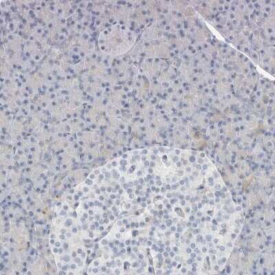 Immunohistochemistry-Paraffin: ATCAY Antibody [NBP2-48537]