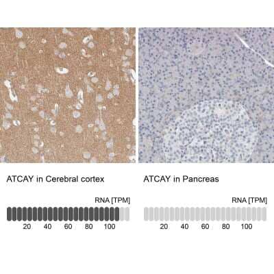 Immunohistochemistry-Paraffin: ATCAY Antibody [NBP2-48537]