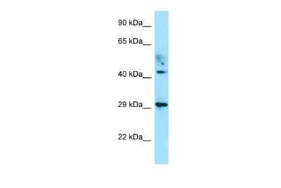 Western Blot: ATCAY Antibody [NBP2-87048]