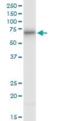 Western Blot: ATE1 Antibody (2B6) [H00011101-M01]