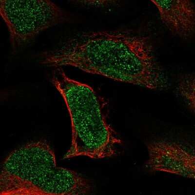 Immunocytochemistry/ Immunofluorescence: ATE1 Antibody [NBP1-85872]