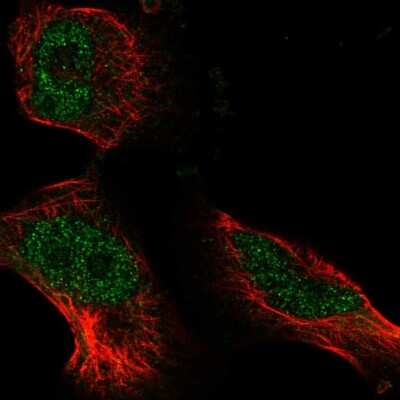 Immunocytochemistry/ Immunofluorescence: ATE1 Antibody [NBP2-55688]