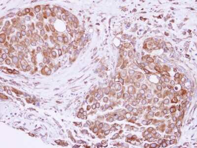 Immunohistochemistry-Paraffin: ATE1 Antibody [NBP2-15494]