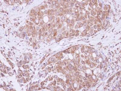 Immunohistochemistry-Paraffin: ATE1 Antibody [NBP2-15495]