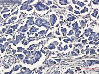 Immunohistochemistry-Paraffin: ATE1 Antibody (S09-6D4) [NBP3-19575]