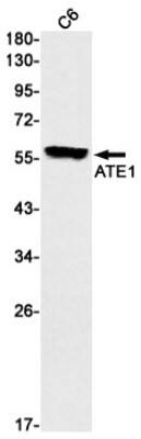 Western Blot: ATE1 Antibody (S09-6D4) [NBP3-19575]