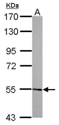 Western Blot: ATE1 Antibody [NBP2-15494]