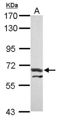 Western Blot: ATE1 Antibody [NBP2-15495]