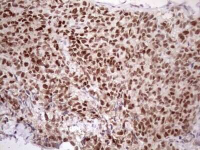 Immunohistochemistry: ATF1 Antibody (OTI2B4) [NBP2-46552]