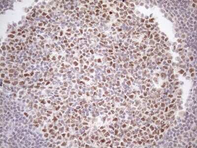 Immunohistochemistry: ATF1 Antibody (OTI2B4) [NBP2-46552]