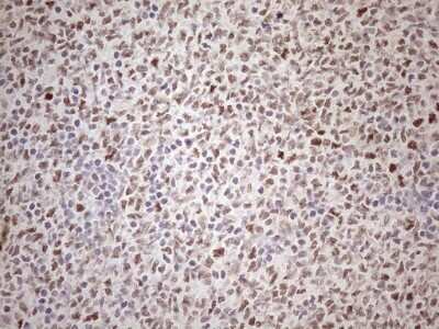 Immunohistochemistry: ATF1 Antibody (OTI2B4) [NBP2-46552]