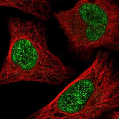 Immunocytochemistry/ Immunofluorescence: ATF1 Antibody [NBP2-56846]