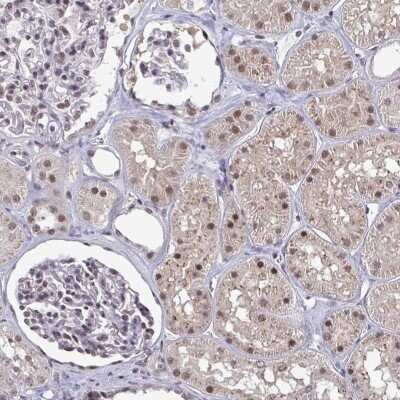 Immunohistochemistry: ATF1 Antibody [NBP2-38747]