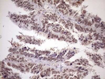 Immunohistochemistry: ATF1 Antibody (OTI2B4) - Azide and BSA Free [NBP2-70218]