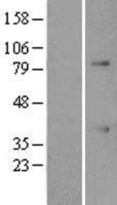 Western Blot: ATF1 Overexpression Lysate [NBL1-07787]