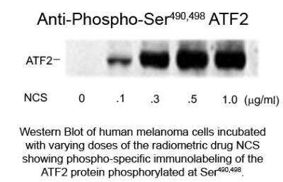 Western Blot: ATF2 [p Ser490, p Ser498] Antibody [NB300-257]