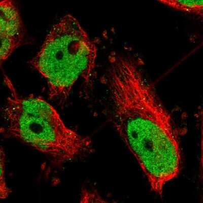 Immunocytochemistry/ Immunofluorescence: ATF2 Antibody [NBP1-85457]