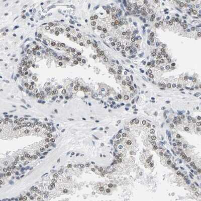 Immunohistochemistry-Paraffin: ATF2 Antibody [NBP1-85457]